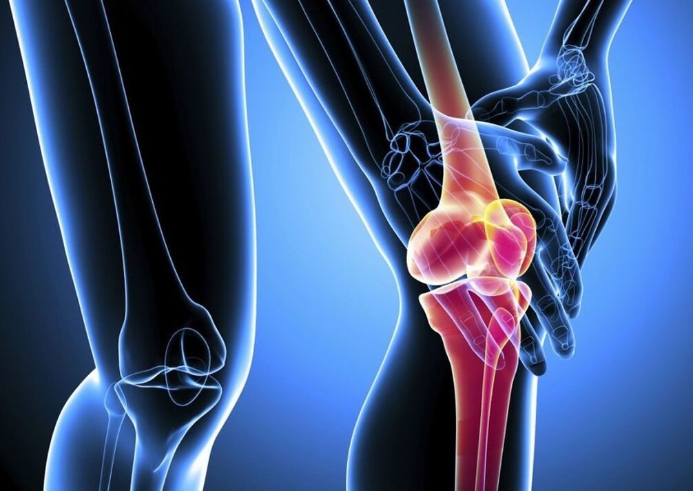 Πόνος κατά τη σωματική δραστηριότητα στην οστεοαρθρίτιδα της άρθρωσης του γόνατος
